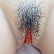 Poils pubiens:Style #1